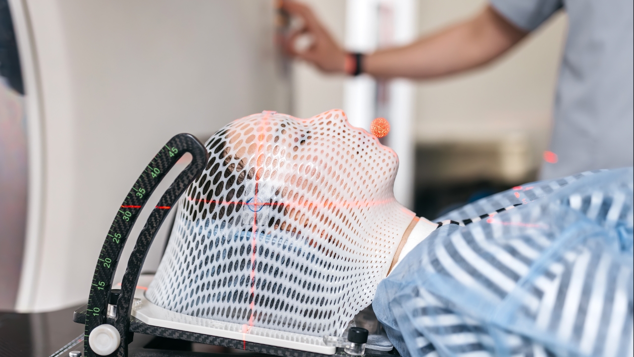 รู้จัก “การฉายรังสีร่วมพิกัดสมอง” เทคนิคการรักษาที่แม่นยำสูง