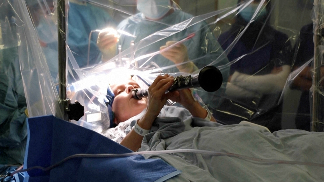 สุดทึ่ง! หญิงอังกฤษเล่นคลาริเน็ตขณะถูกผ่าสมอง ทดสอบผลผ่าตัดรักษาพาร์กินสันแบบเรียลไทม์