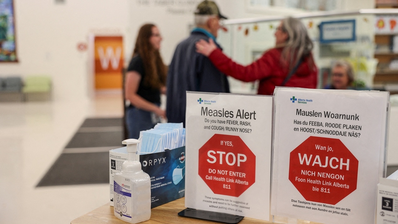 แคนาดาเสียสถานะ “ปลอดโรคหัด” แล้ว หลังเชื้อระบาดต่อเนื่อง