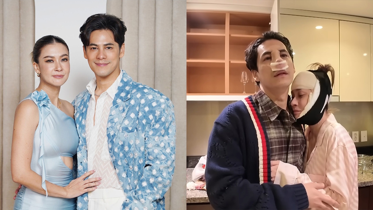 เอมี่ บินทำหน้าย้อนวัยที่เกาหลี ซี ศิวัฒน์ แก้จมูกใหม่ใช้กระดูกซี่โครง (คลิป)