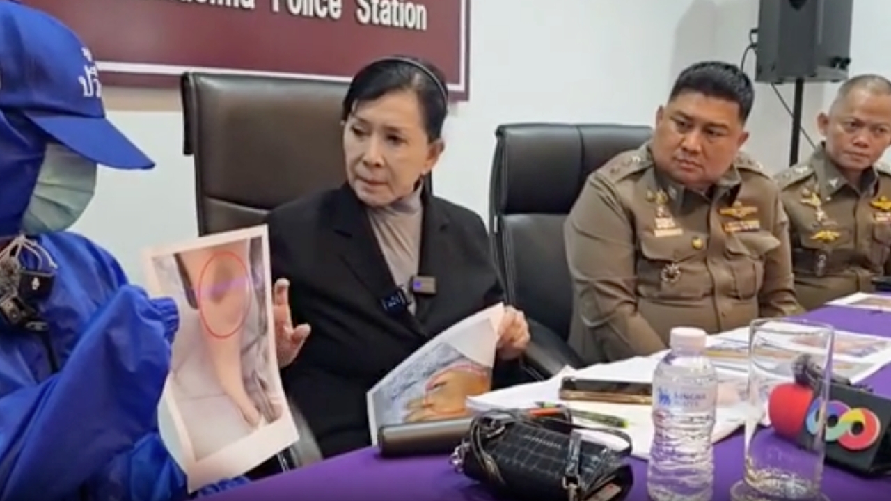 จ่อแจ้ง 3 ข้อหาหนัก “ส.ต.อ.” สันติบาล ซ้อมกักขังพยาบาลสาว พบฉี่ม่วง-สั่งฟันวินัยซ้ำ