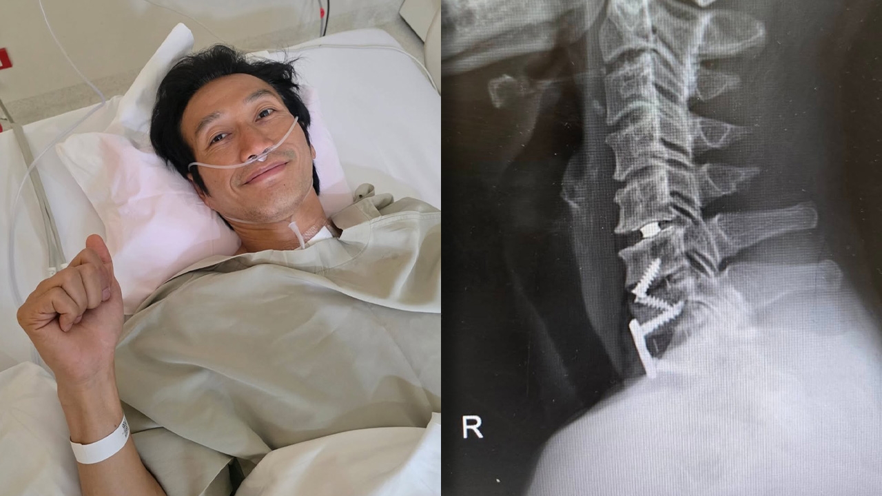 ตูน บอดี้สแลม เปิดใจหลังผ่าตัดรอบที่ 4 เหตุหมอนรองกระดูกเสื่อม น็อตหลวม