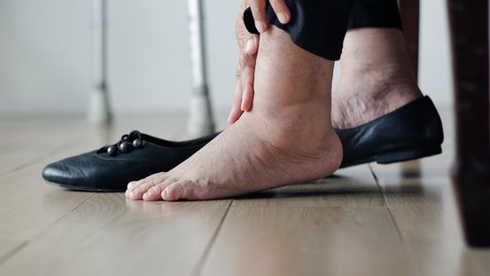 เช็กสัญญาณอันตราย "เบาหวานลงเท้า" ปล่อยไว้อาจถึงขั้นตัดขา พร้อมวิธีดูแลตัวเอง