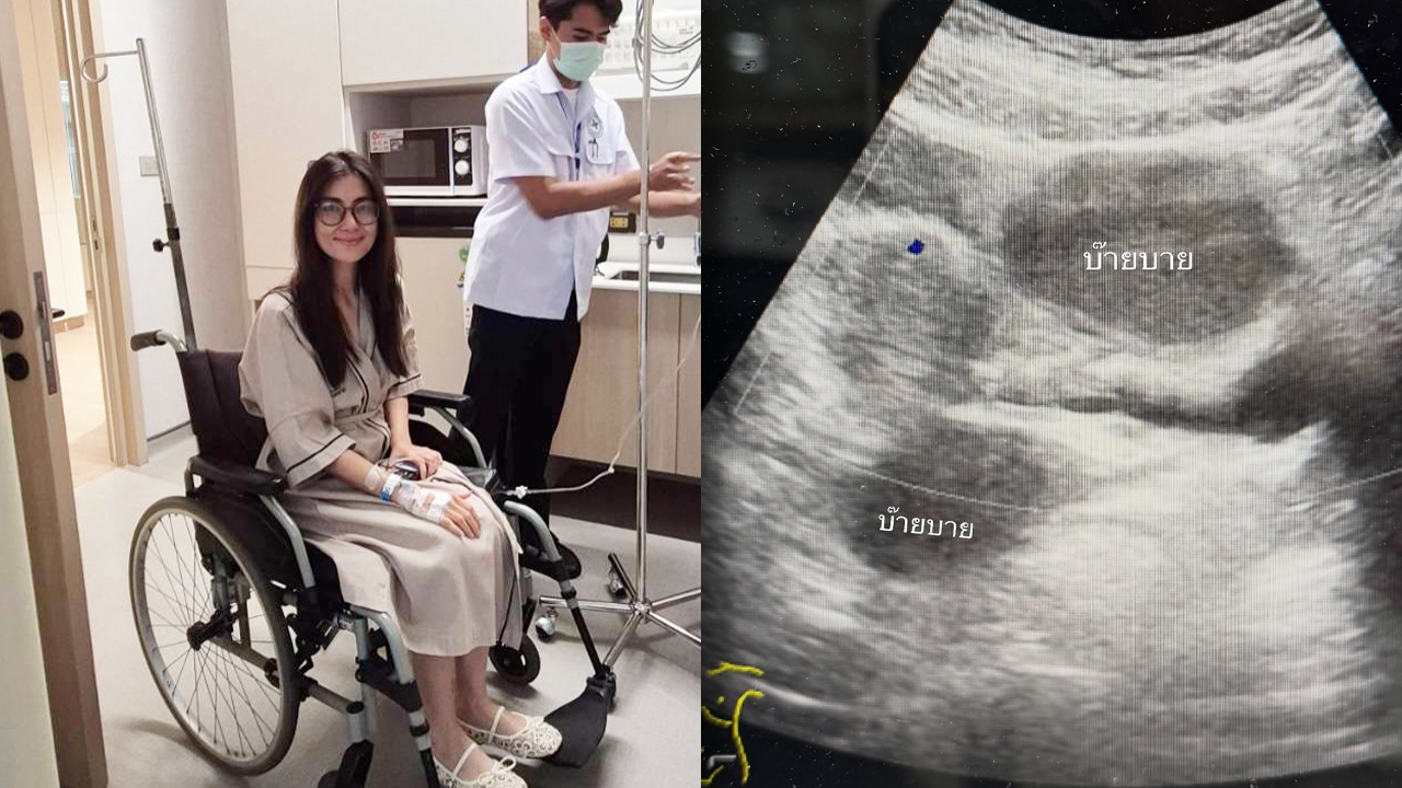 ส่งกำลังใจ! “จ๊ะจ๋า พริมรตา” แอดมิทด่วน ผ่าตัดช็อกโกแลตซีสต์ 2 ลูกโต 