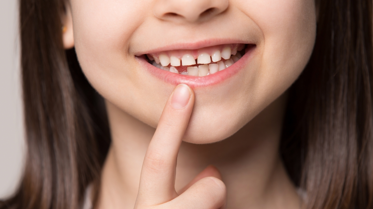 การรักษารากฟันน้ำนมในเด็ก