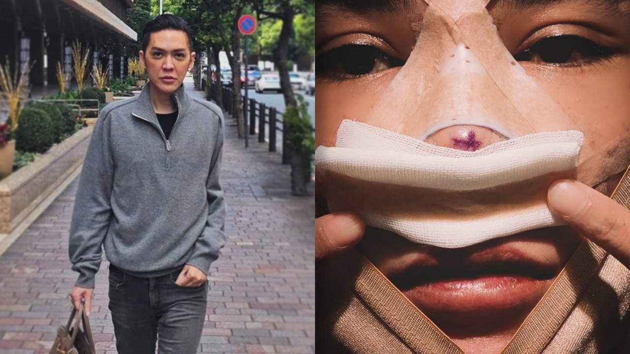 ดัง พันกร เผยภาพเซตใหม่ใต้ผ้าพันแผล เตรียมเปิดหน้าใหม่สุดจึ้ง