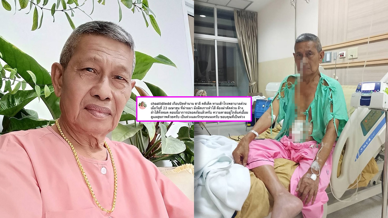 ชาลี คดีเด็ด โพสต์แจ้งข่าว เกือบสิ้นชื่อ หลังถูกนำตัวส่งโรงพยาบาลผ่าตัดด่วน!