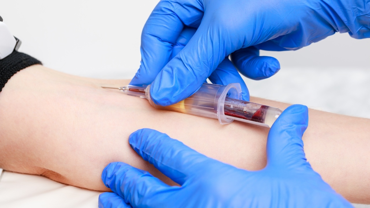 "สภาเทคนิคการแพทย์" ชี้แจงประเด็น "งดน้ำ-งดอาหาร" ก่อนการเจาะเลือด