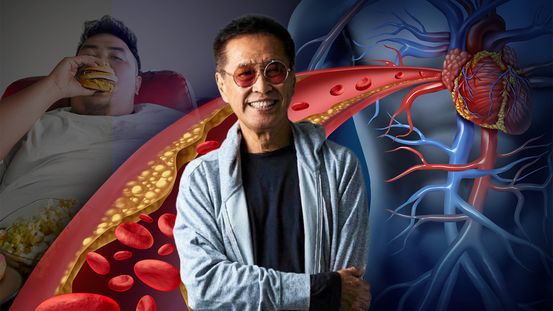 พลิกตำราโภชนาการ ปฏิวัติ! พีระมิดอาหาร