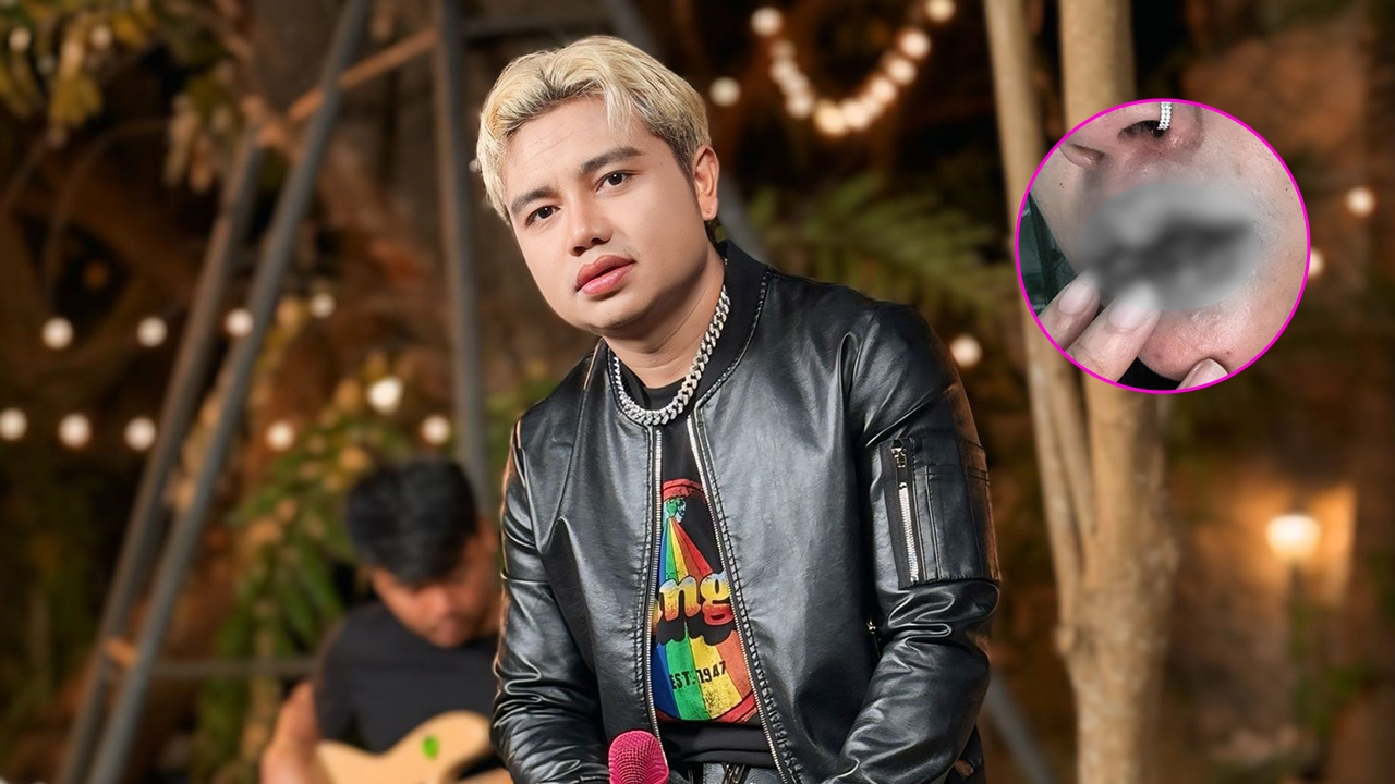 ดราม่าสนั่นโซเชียล แฟนสาวแฉยับถูก ครูไพบูลย์ ลงไม้ลงมือ ลั่นครั้งนี้ไม่ยอมความ