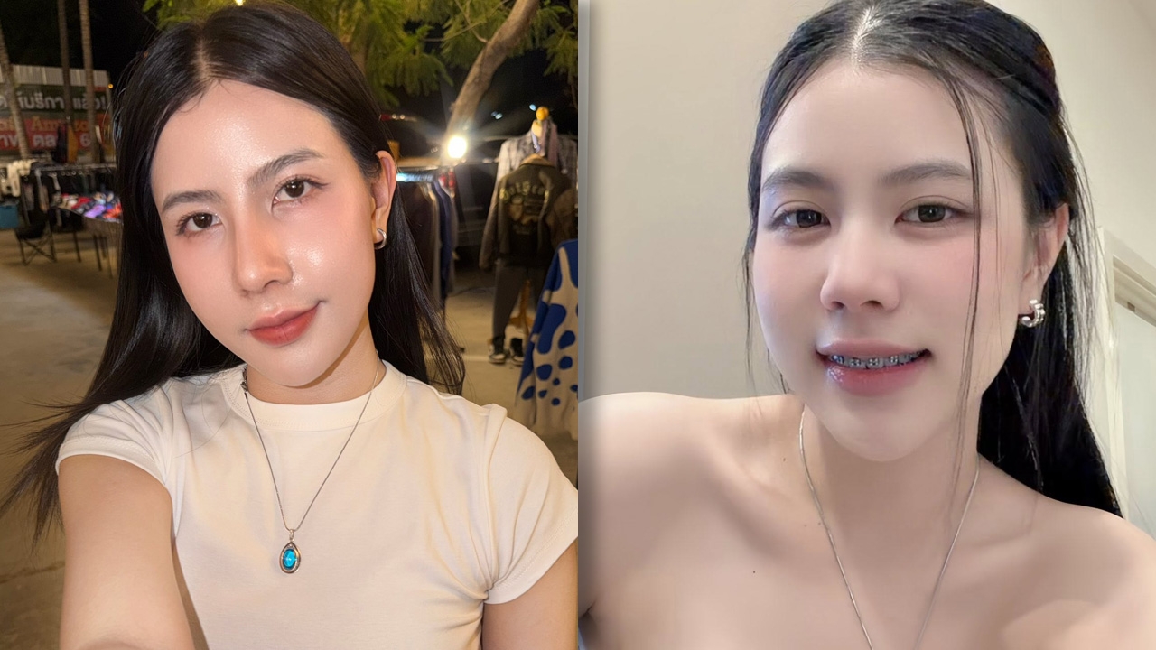 เปิดลุคใหม่ “กระต่าย พรรณนิภา” หลังทำจมูก แต่แอบเครียดหนักคนทักไม่สวยเท่าเดิม