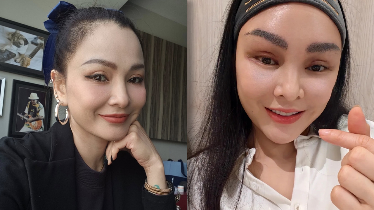 แคนดี้ รากแก่น ขึ้นเขียงทำศัลยกรรม บอกหมดทำอะไรบ้าง ลั่นรอพบศิลปินหน้าใหม่ได้เลย