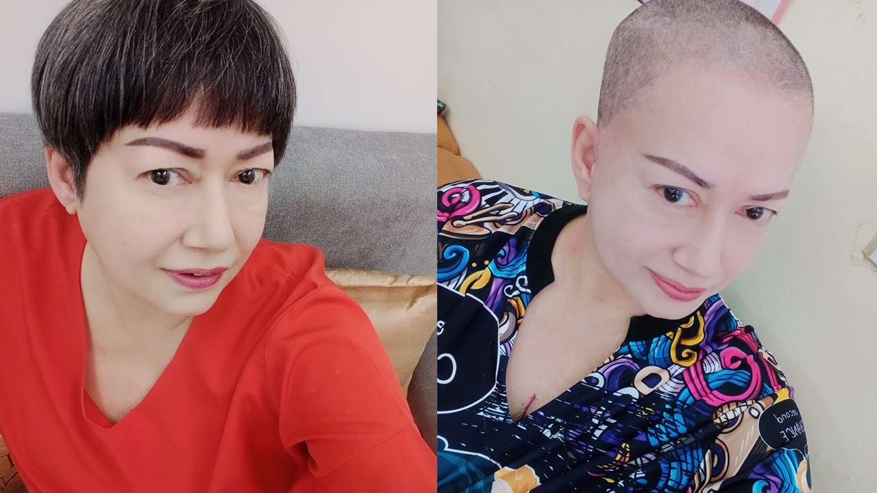 แหม่ม อลิษา โพสต์ความในใจก่อนเข้ารับผ่าตัดรักษามะเร็งปอด แฟนๆ ส่งกำลังใจจำนวนมาก