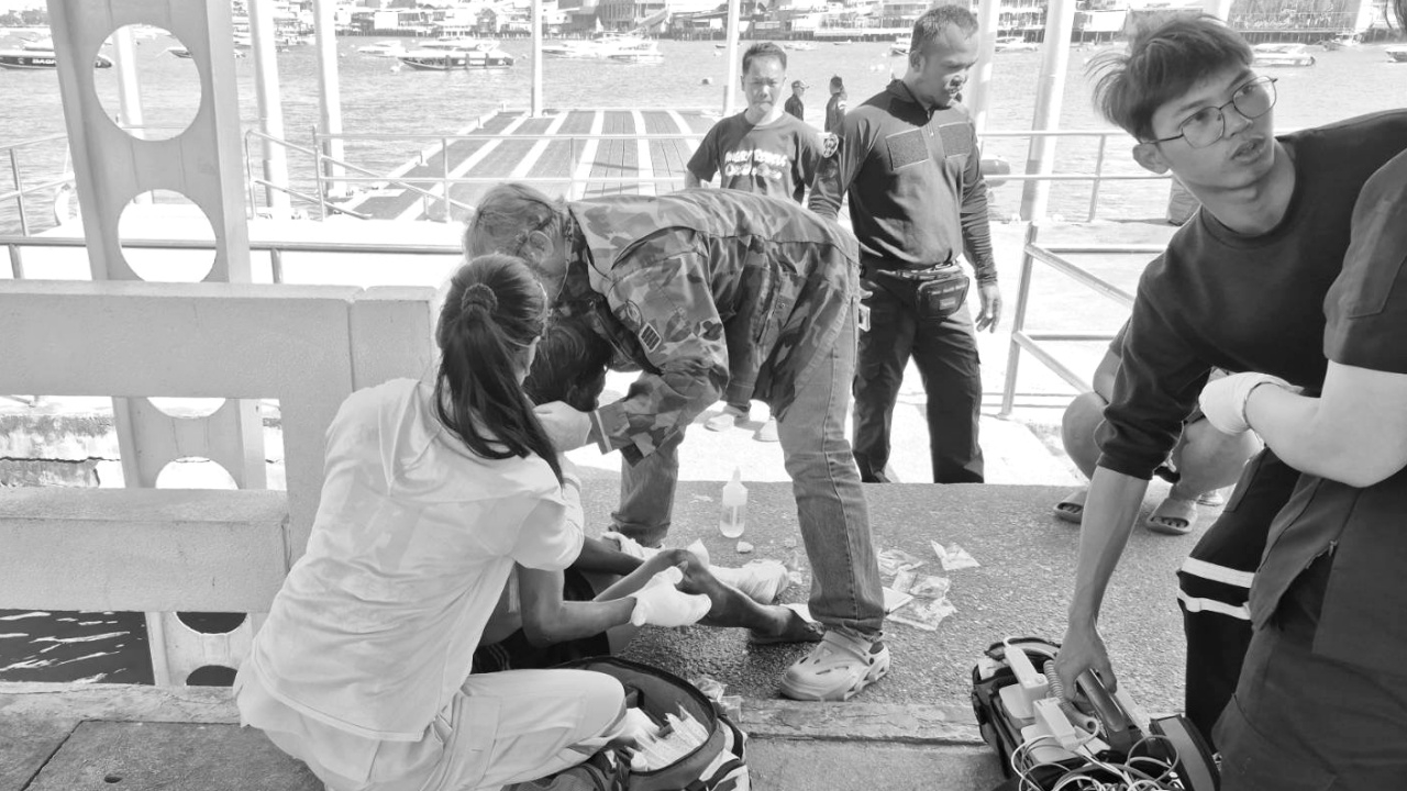 หนุ่มกัมพูชา ถูกไฟคลอกร่าง 80% นั่งรถจากหัวหินมาหาเมียที่พัทยา ให้พาส่ง รพ.