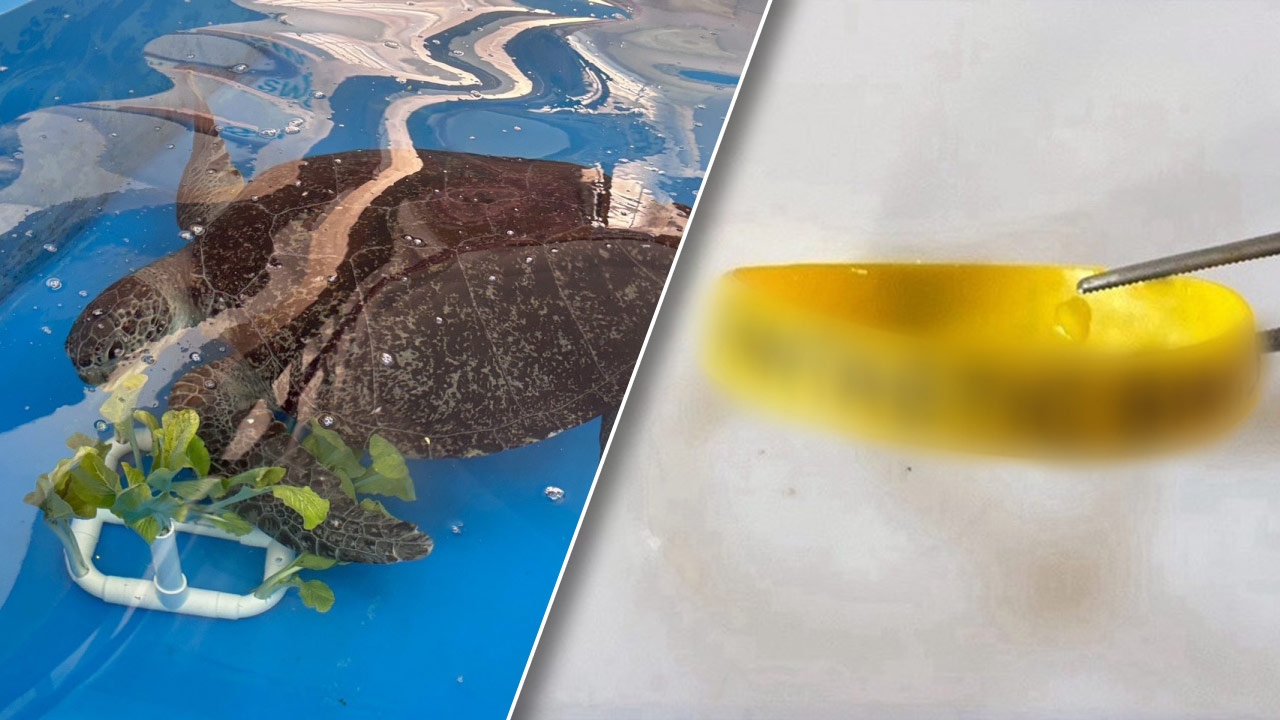 "เต่าทะเล" กลืนสายรัดข้อมือจากนักท่องเที่ยว ใช้เวลา 27 วัน ล่าสุดขับออกได้แล้ว