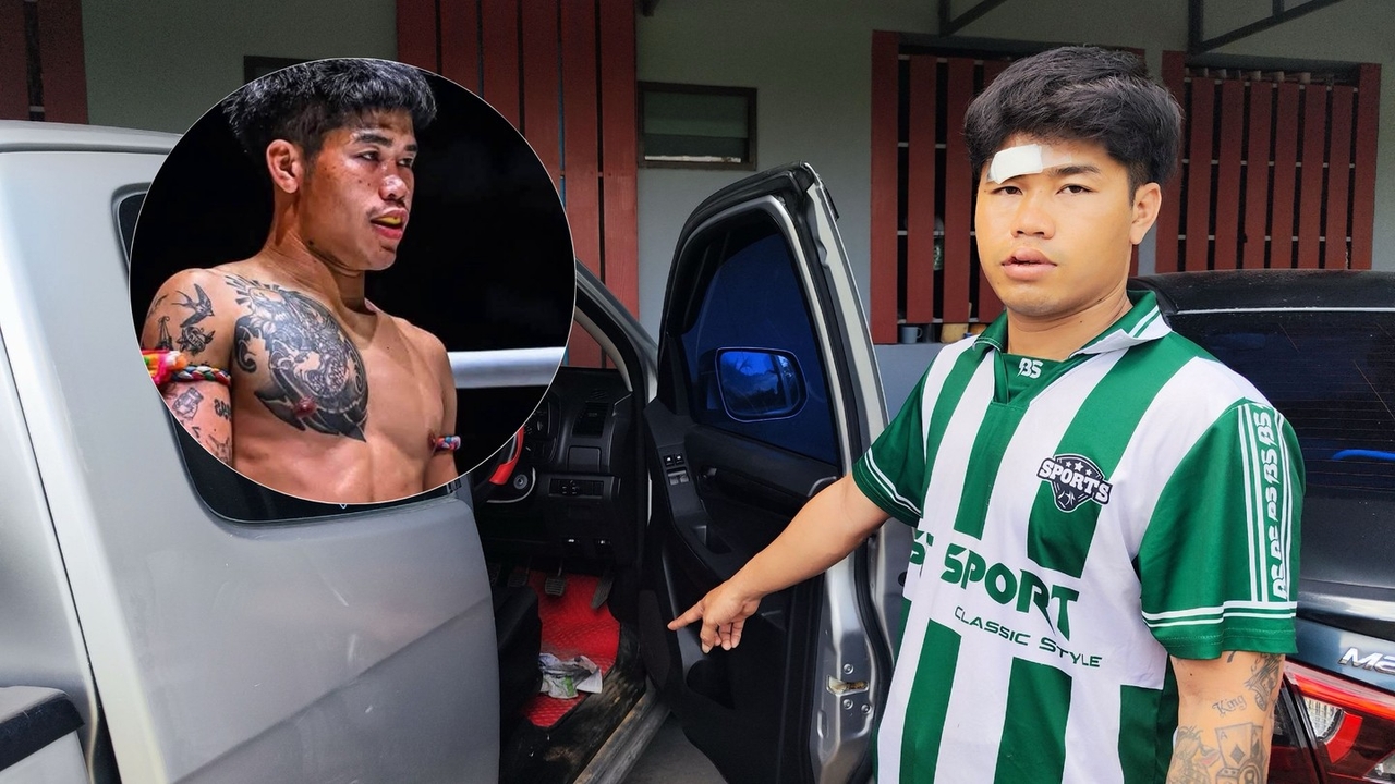 "เงาพยัคฆ์" นักมวย ONE ลุมพินี ถูกต่อยเจ็บ-ฟันหัก กลางถนน คาดปมเหตุขับปาดหน้า