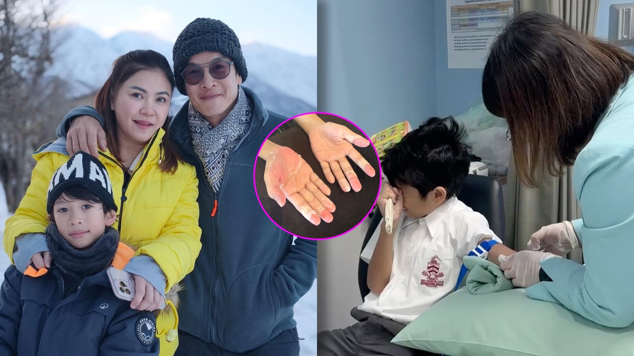 ชาคริต-แอน โล่งใจ อัปเดตอาการ น้องโพธิ์ ลิ้นหัวใจรั่วเกือบปิดสนิท มือเท้าลอกจนเกือบหมดแล้ว