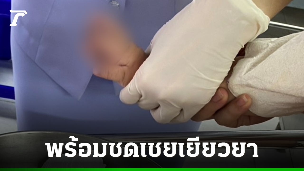 医院对一名1岁男童食指被切断的事件表示遗憾，并确认愿意提供全面的赔偿和补救措施。