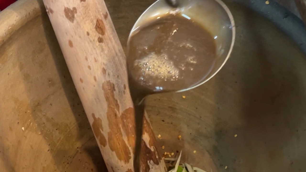 หมอ มข. เผย Gen z ติดเชื้อพยาธิใบไม้ตับเพิ่มขึ้น ห่วงกินดิบตามอินฟลูเอนเซอร์