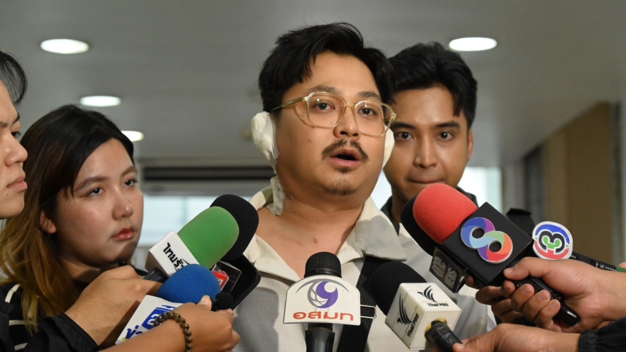 หัวหน้าวงทศกัณฐ์ เผย “ดิน” ยังอาการทรงตัว แม้ถูกไฟคลอกกว่า 80%
